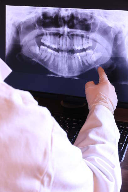 Best Emergency TMJ Treatment in Creston, IA