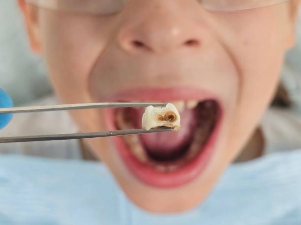 Best Cosmetic Emergency Dentistry in Creston, IA